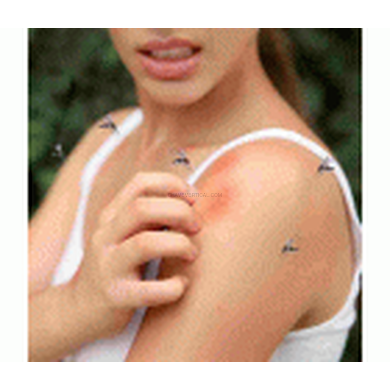 PULSERA ANTI-MOSQUITOS ULTRASONICA XANLITE EG-BRAMOUSN
